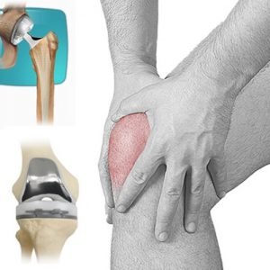 knee replacement surgery in West Delhi